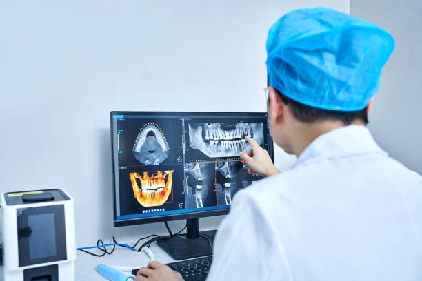 Best Emergency Wisdom Tooth Extraction in San Andreas, CA